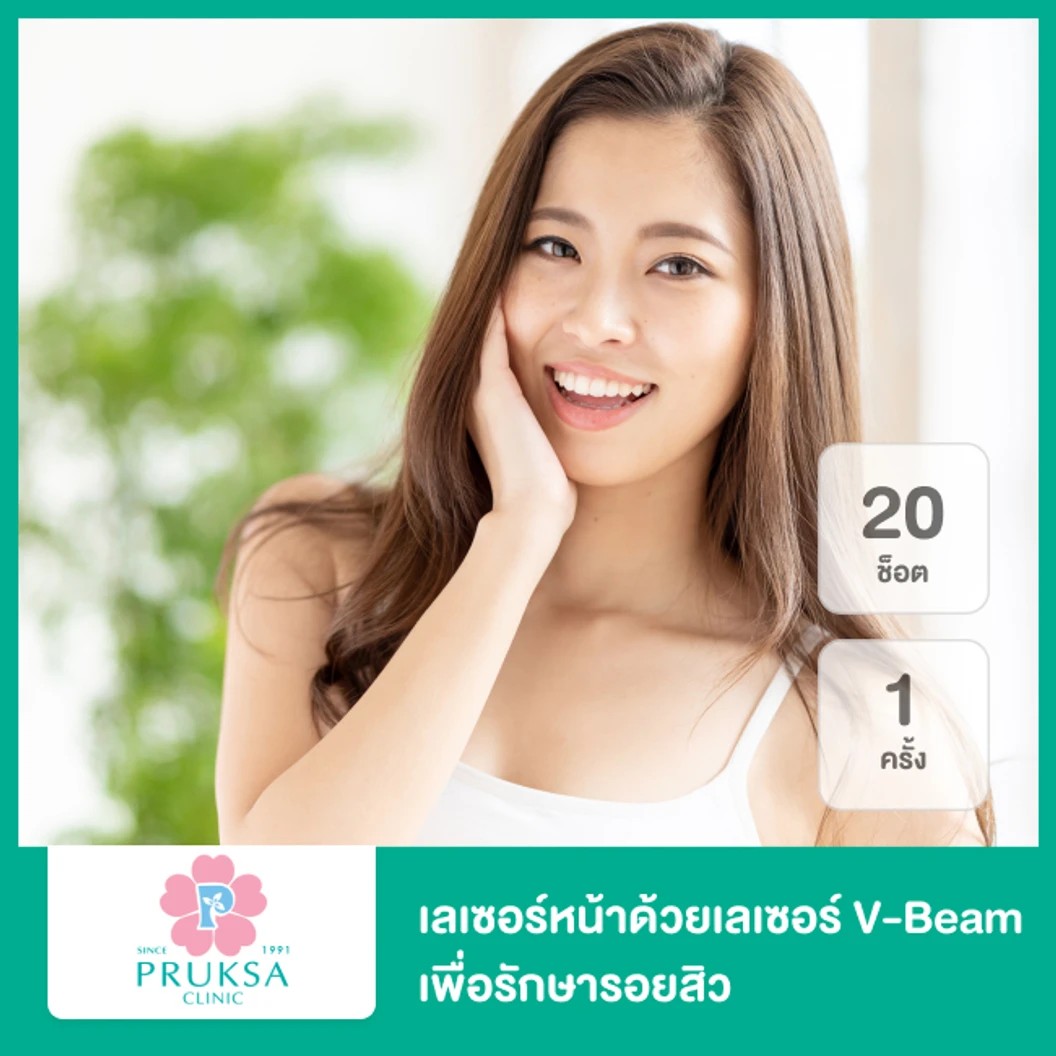 เลเซอร์หน้าด้วยเลเซอร์ V-Beam เพื่อรักษารอยสิว 20 ช็อต 1 ครั้ง