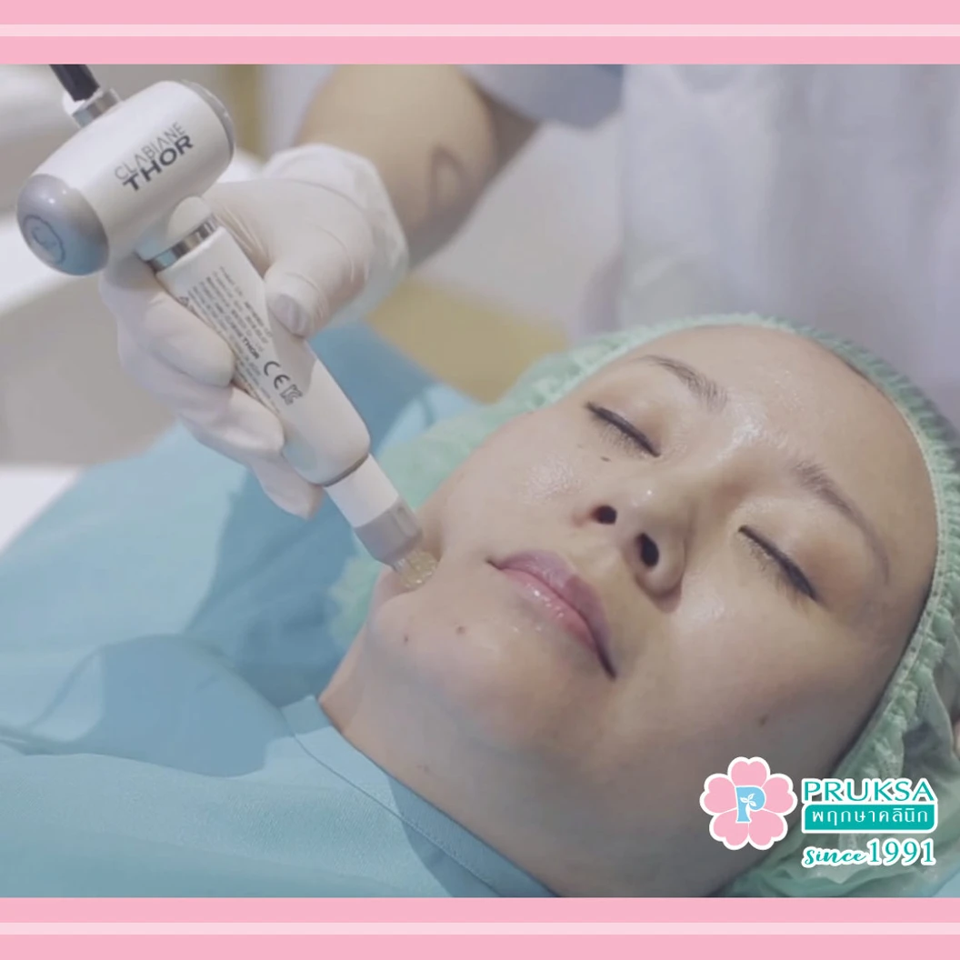 ทำทรีตเมนต์ MS Renew Program ลดริ้วรอย กระชับรูขุมขน เพิ่มความกระจ่างใส 1 ครั้ง
