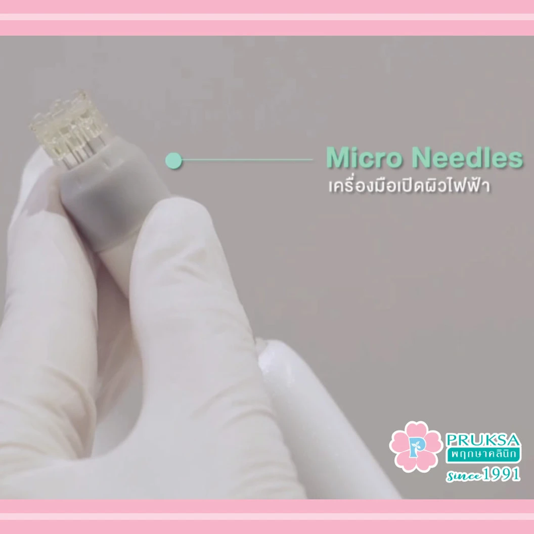 ทำทรีตเมนต์ MS Renew Program ลดริ้วรอย กระชับรูขุมขน เพิ่มความกระจ่างใส 1 ครั้ง