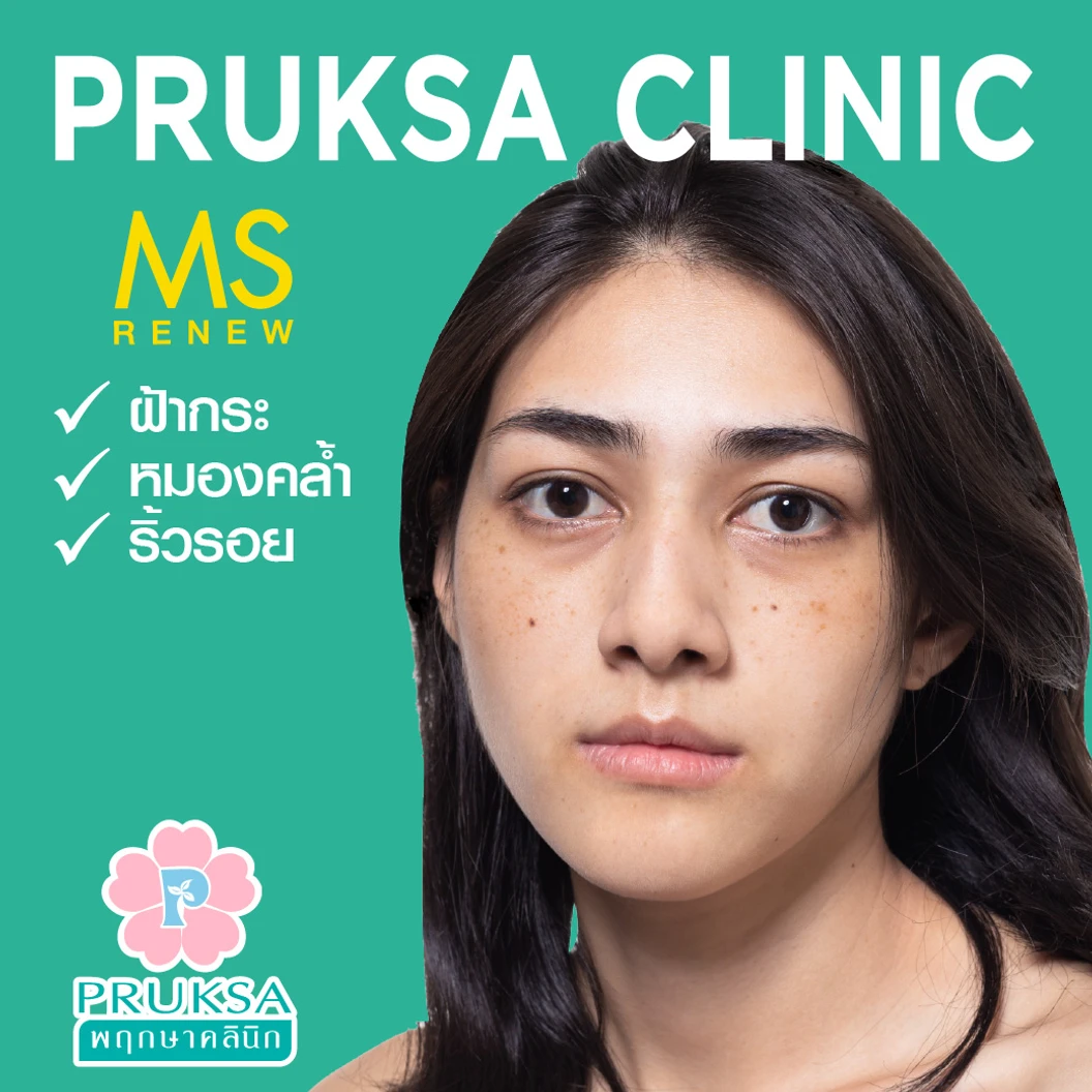 ทำทรีตเมนต์ MS Renew Program ลดริ้วรอย กระชับรูขุมขน เพิ่มความกระจ่างใส 1 ครั้ง