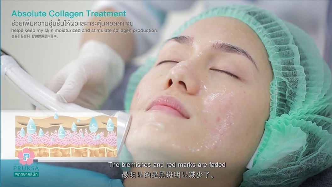 ทำทรีตเมนต์ผิวหน้า 3 ขั้นตอน 1 ครั้ง เพื่อฟื้นฟูผิว ช่วยให้ผิวชุ่มชื้นแข็งแรง (Absolute Collagen Program)