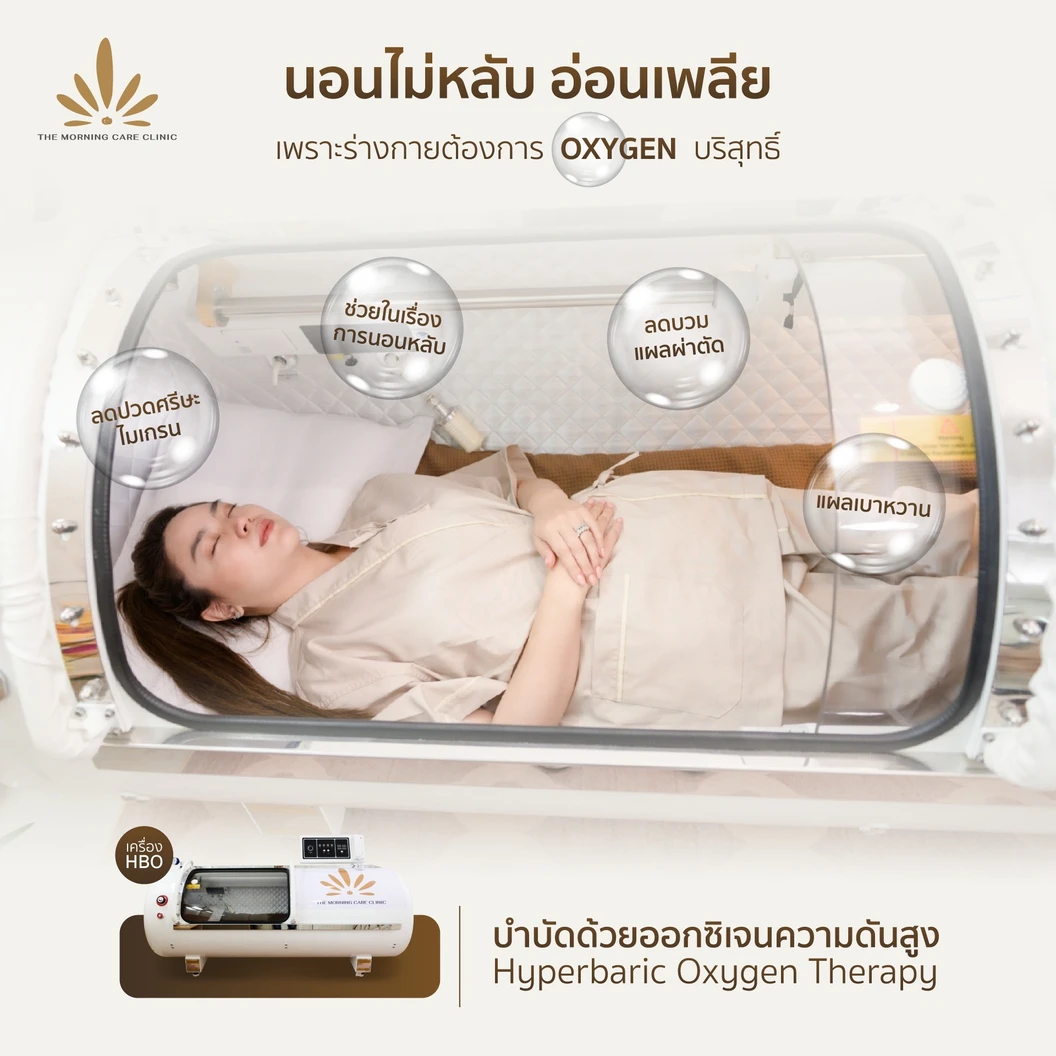 ทำไฮเปอร์แบริก (HBO) บำบัดร่างกายด้วยออกซิเจนบริสุทธิ์ 30 นาที 1 ครั้ง