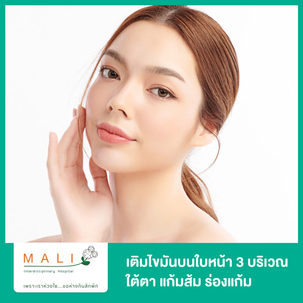 เติมไขมันบนใบหน้า 3 บริเวณ (ใต้ตา แก้มส้ม ร่องแก้ม) ปริมาณและจุดที่ฉีดขึ้นอยู่กับแพทย์ประเมิน