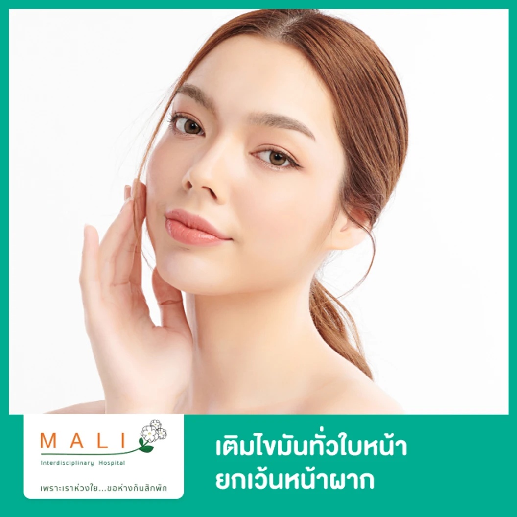 เติมไขมันทั่วใบหน้า ยกเว้นหน้าผาก ปริมาณและจุดที่ฉีดขึ้นอยู่กับแพทย์ประเมิน