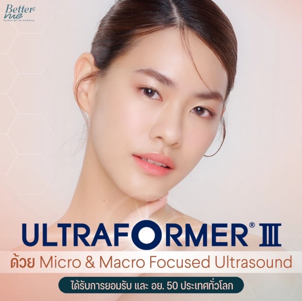 ยกกระชับใบหน้า ด้วยเครื่อง Ultraformer lll 600 ช็อต บริเวณที่มีปัญหา 1 ครั้ง