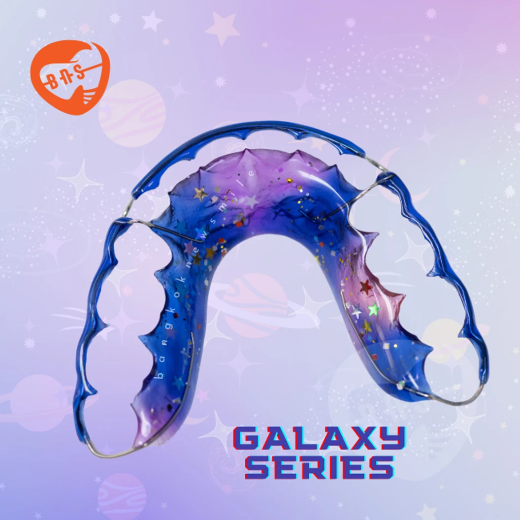 ทำรีเทนเนอร์แบบลวด 2 ชิ้น ฟันบนและล่าง