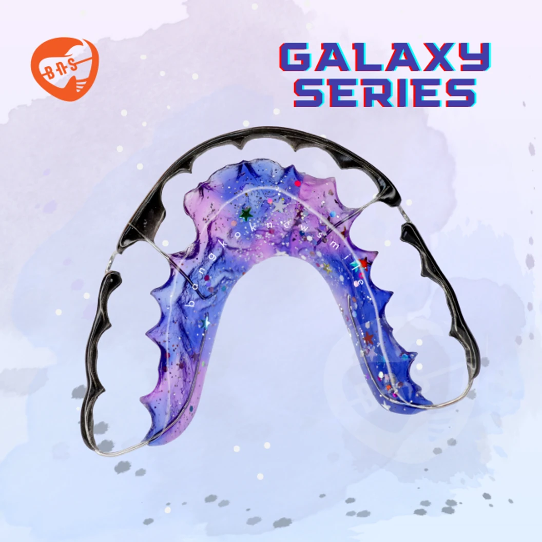 ทำรีเทนเนอร์แบบลวด 2 ชิ้น ฟันบนและล่าง