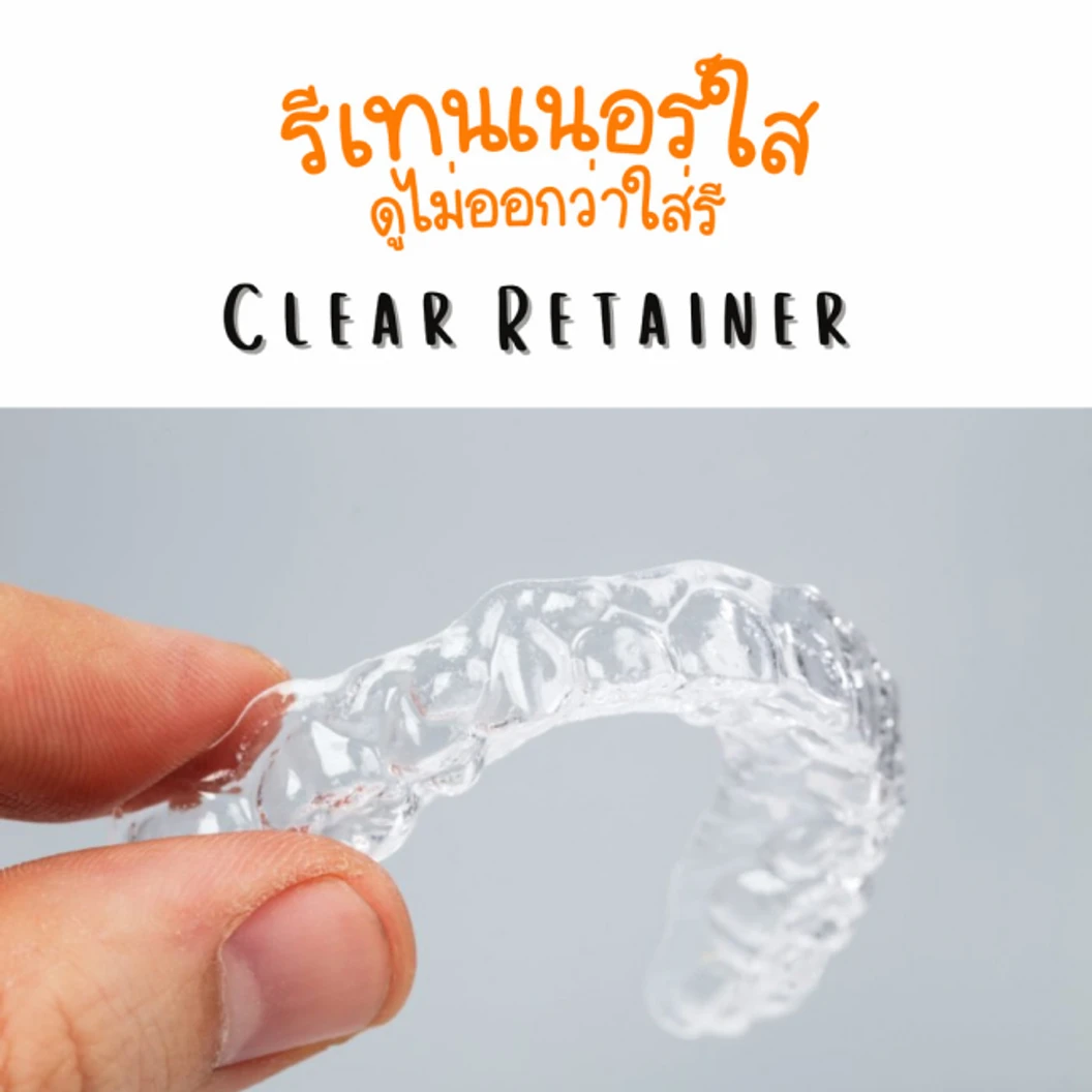 ทำรีเทนเนอร์แบบใส 2 ชิ้น สำหรับฟันบนและล่าง พร้อมขูดหินปูน