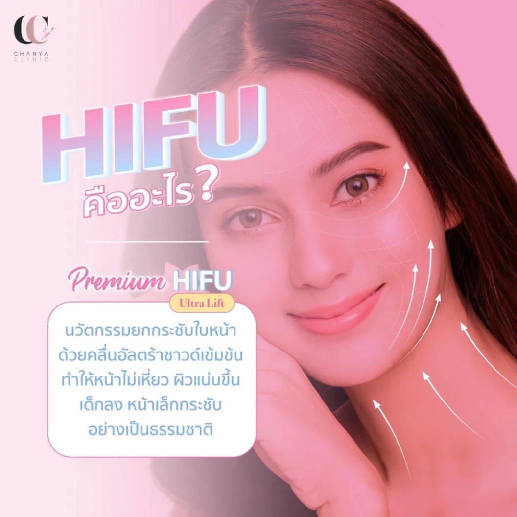 ทำ HIFU ด้วยเครื่อง Ultra Lift 200 ช็อต บริเวณที่มีปัญหา 1 ครั้ง