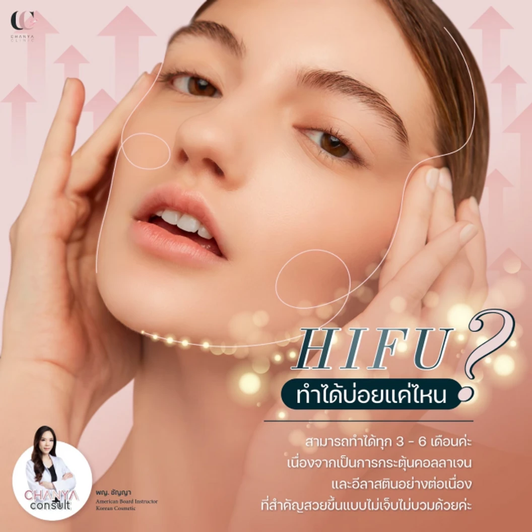 ทำ HIFU ด้วยเครื่อง Ultra Lift 200 ช็อต บริเวณที่มีปัญหา 1 ครั้ง