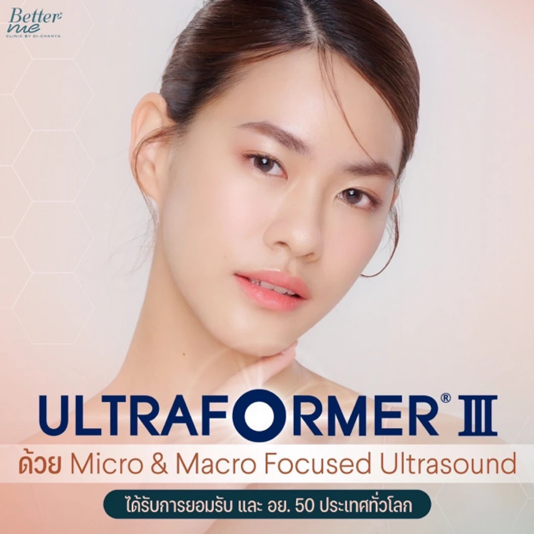 ยกกระชับใบหน้า ด้วยเครื่อง Ultraformer lll 1,000 ช็อต ฟรี! 200 ช็อต บริเวณที่มีปัญหา 1 ครั้ง
