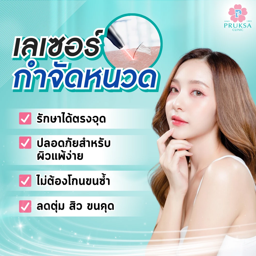 กำจัดขนหนวดด้วย Diode Laser 1 ครั้ง