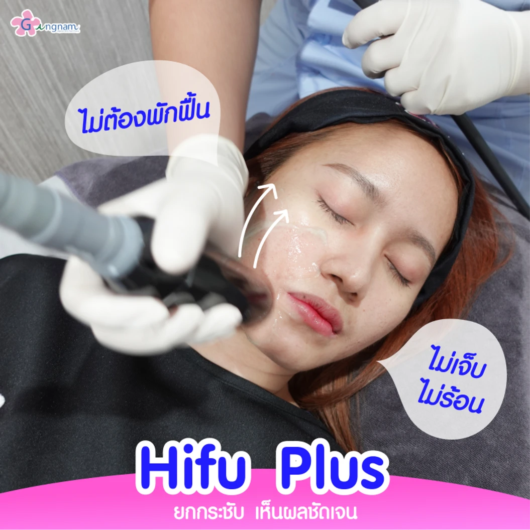 ทำ HIFU เครื่อง Ultra V HIFU Plus ไม่จำกัดช็อต บริเวณแก้มและร่องแก้ม 1 ครั้ง