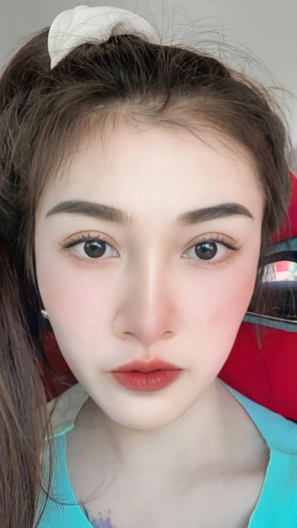 ทำตาสองชั้น แบบกรีดยาว แผลมินิ (แผลเล็กไม่ถึง 1 ซม.) สำหรับเคสทำครั้งแรกและรีวิว