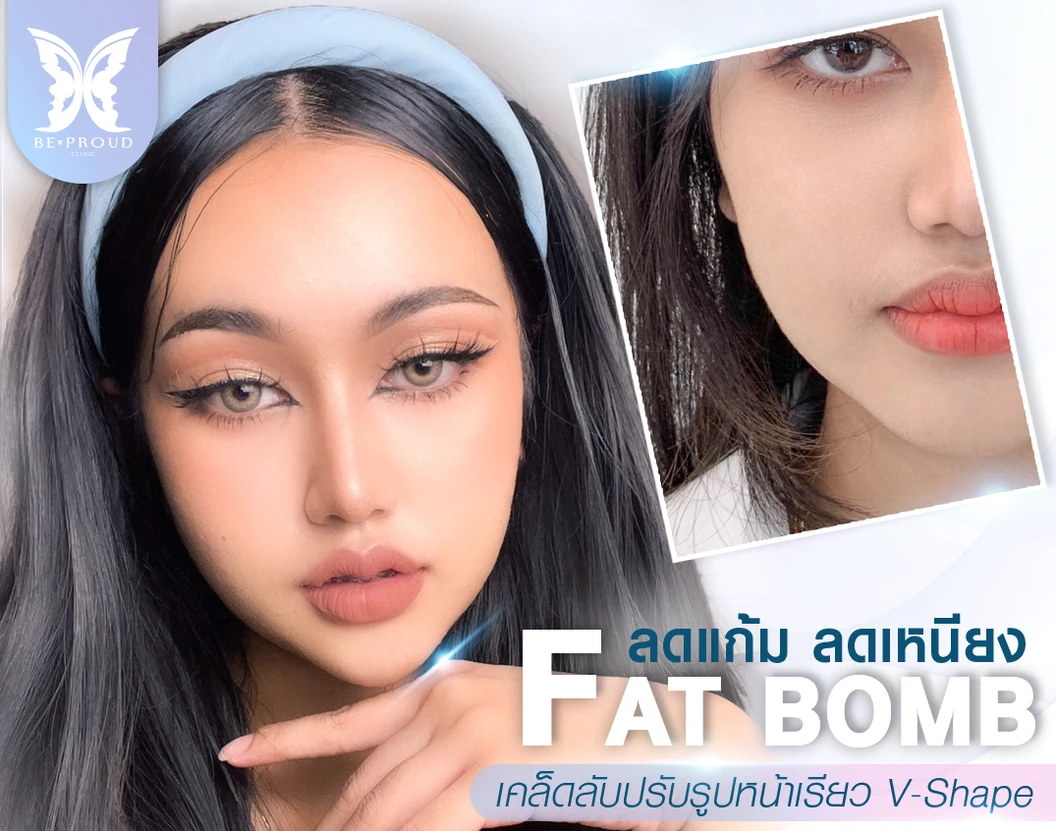 โปรแกรมเมโสแฟต 10 ซีซี เพื่อสลายไขมันส่วนเกินทั่วใบหน้า 1 ครั้ง