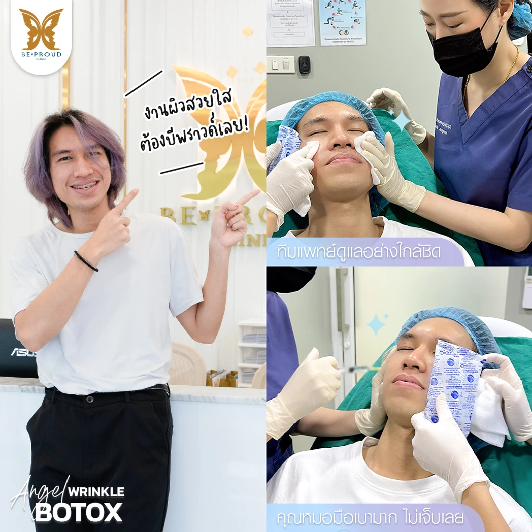 โปรแกรมโบท็อกซ์ 100 ยูนิต (บริเวณที่มีปัญหา)