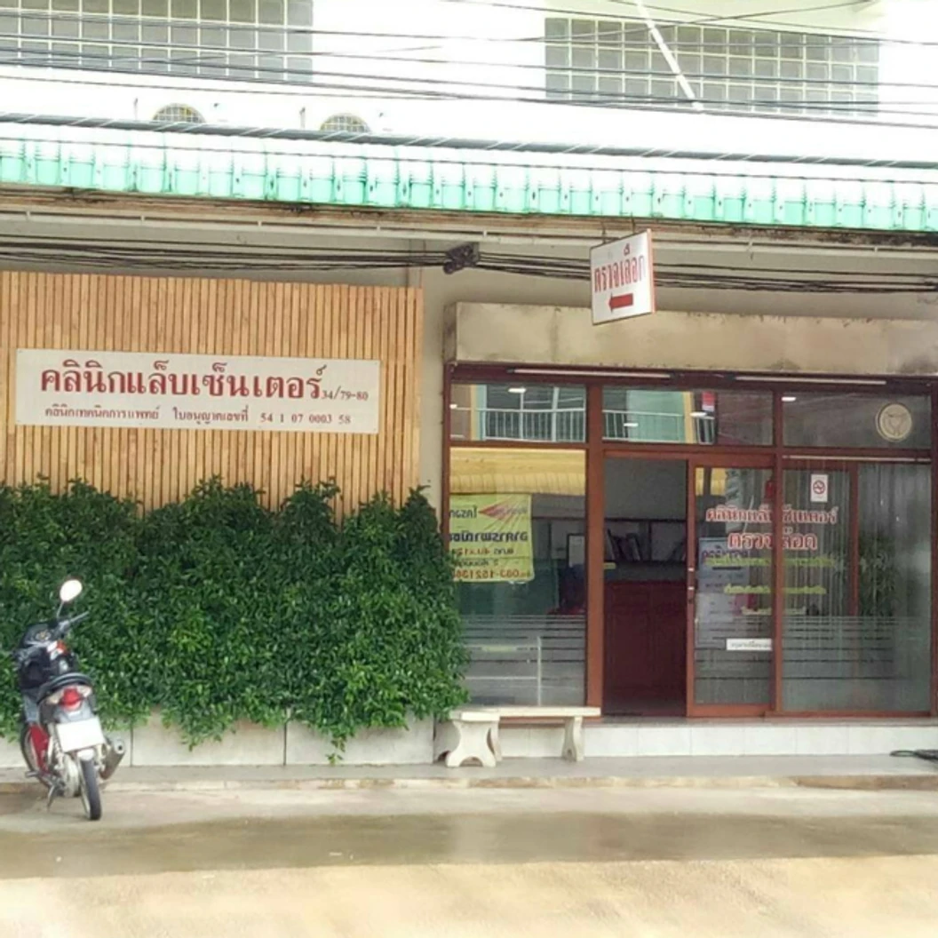 ตรวจหาภูมิต่อไวรัสตับอักเสบซีเบื้องต้น (HCV-Ab)