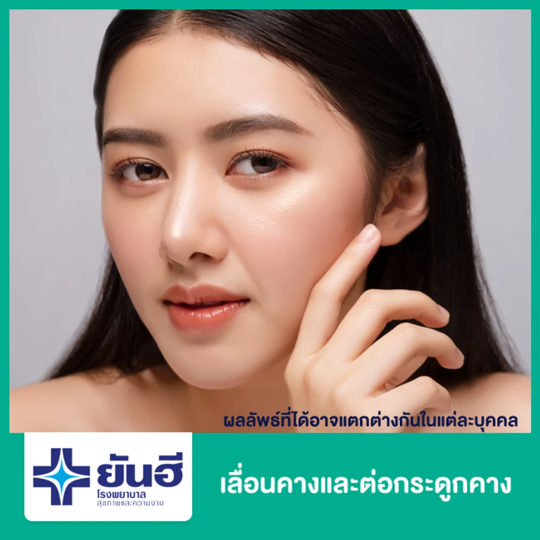ปรับโครงสร้างจมูก โดยใช้กระดูกอ่อนซี่โครง พักฟื้นที่รพ. 1 คืน สำหรับเคสทำครั้งแรกเท่านั้น