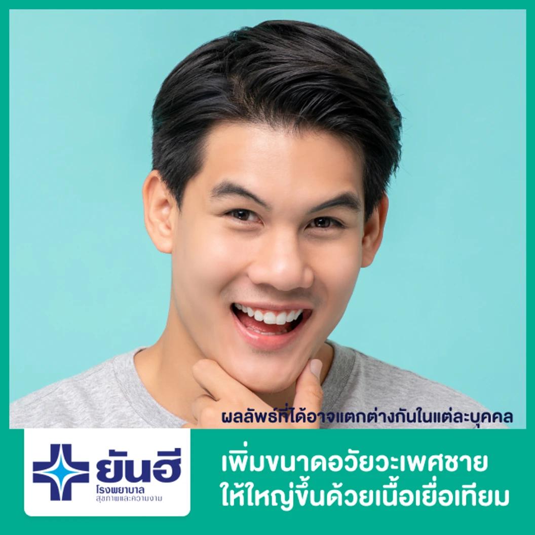 เพิ่มขนาดอวัยวะเพศชายให้ใหญ่ขึ้นด้วยเนื้อเยื่อเทียม (ADM)