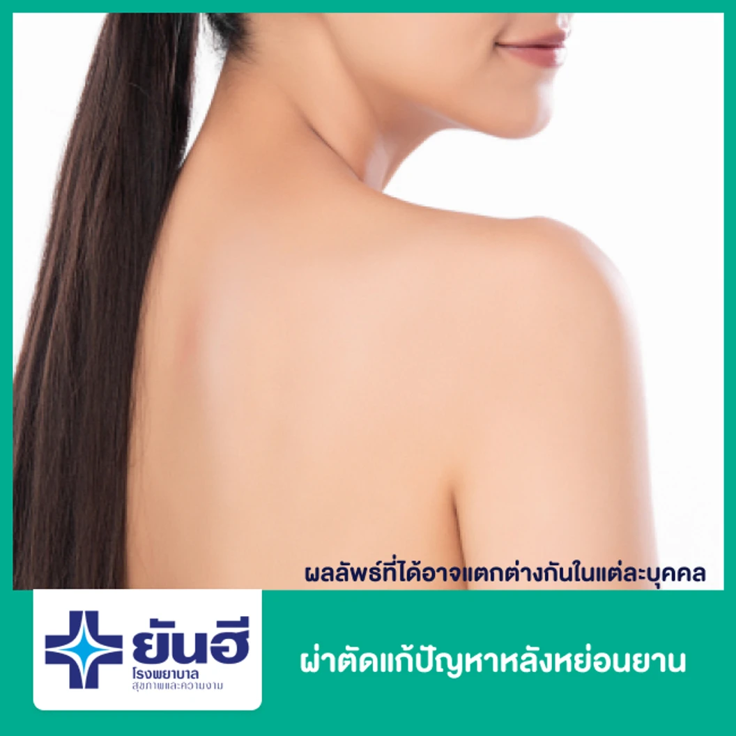 ผ่าตัดแก้ปัญหาหลังหย่อนยาน พักฟื้นที่รพ. 2 คืน