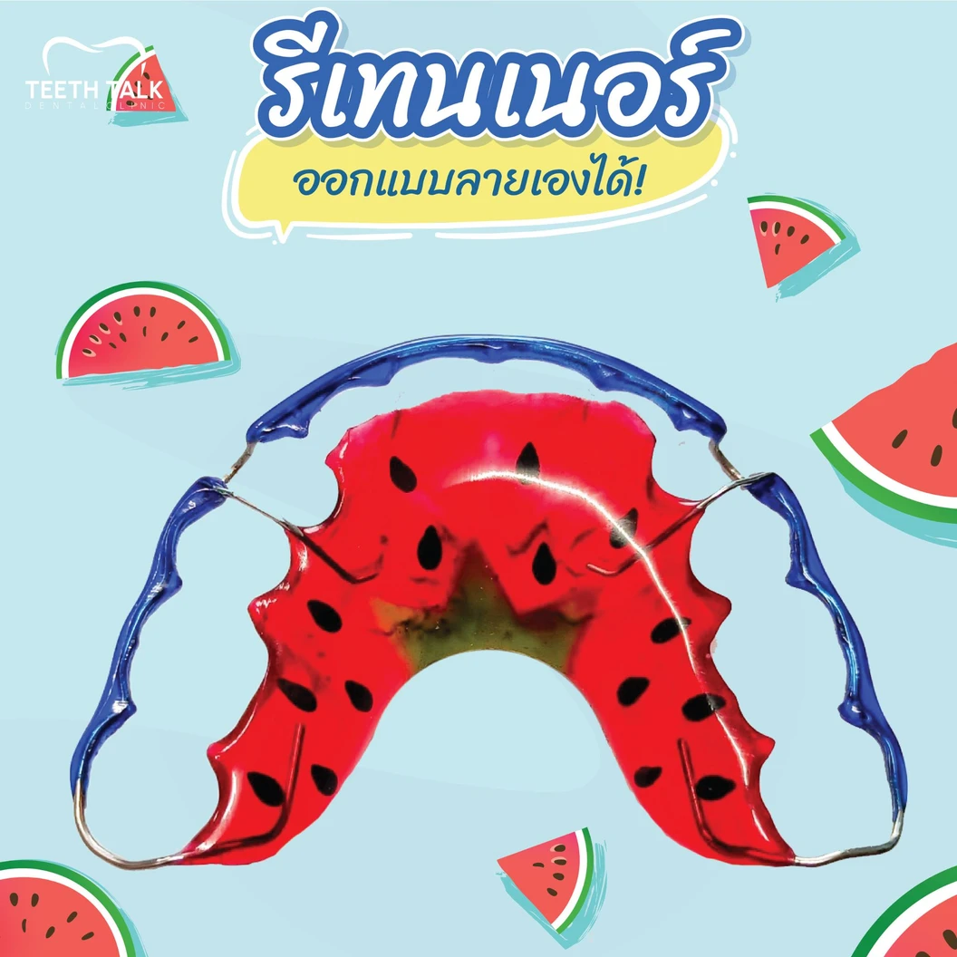 ทำรีเทนเนอร์แบบลวด 2 ชิ้น ฟันบนและล่าง