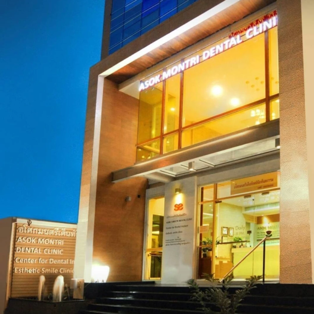 ทำครอบฟัน Palladium 1 ซี่