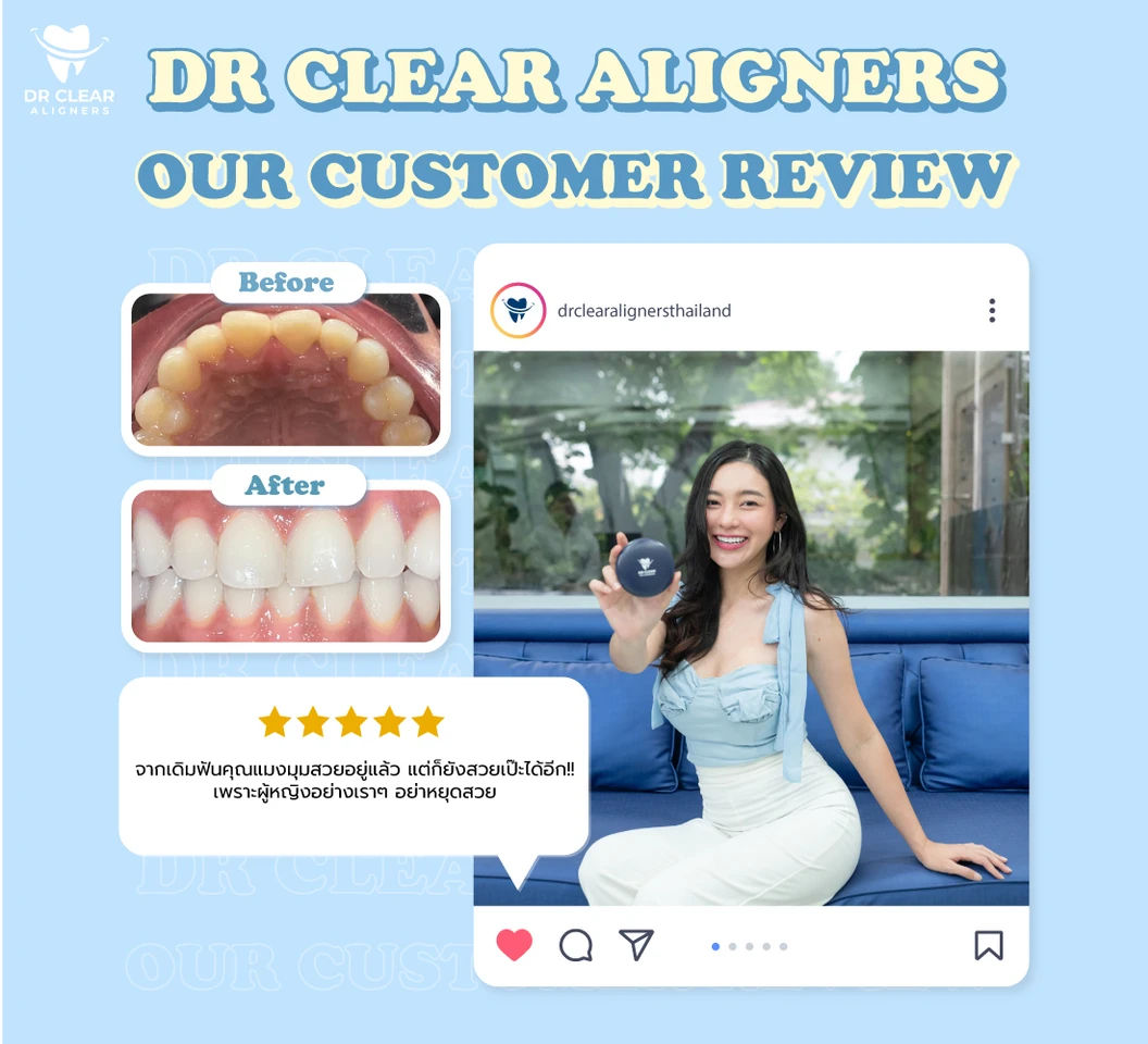 จัดฟันแบบใส Dr. Clear Aligners ฟันบนและล่าง