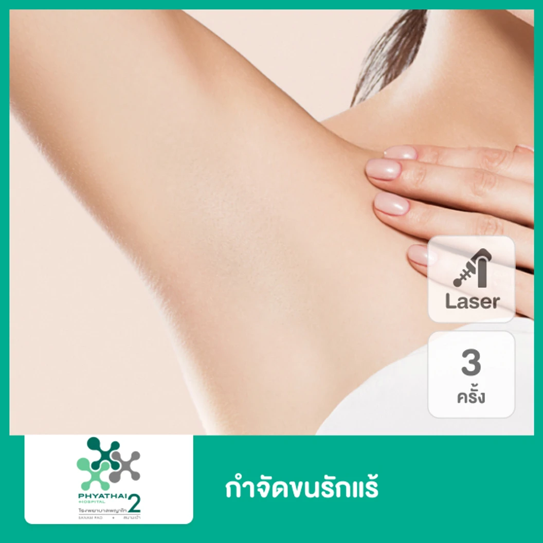 คอร์สเลเซอร์ Gentle YAG กำจัดขนรักแร้ 3 ครั้ง