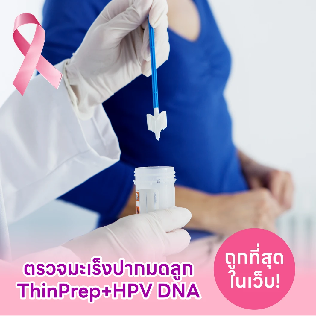 ตรวจมะเร็งปากมดลูก ThinPrep และตรวจหาเชื้อ HPV DNA