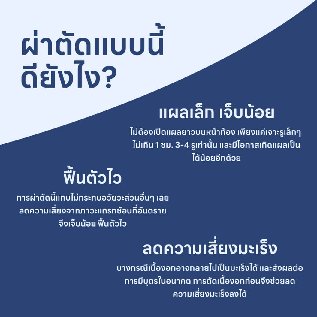 ผ่าตัดเนื้องอกมดลูก (แบบส่องกล้องทางหน้าท้อง)