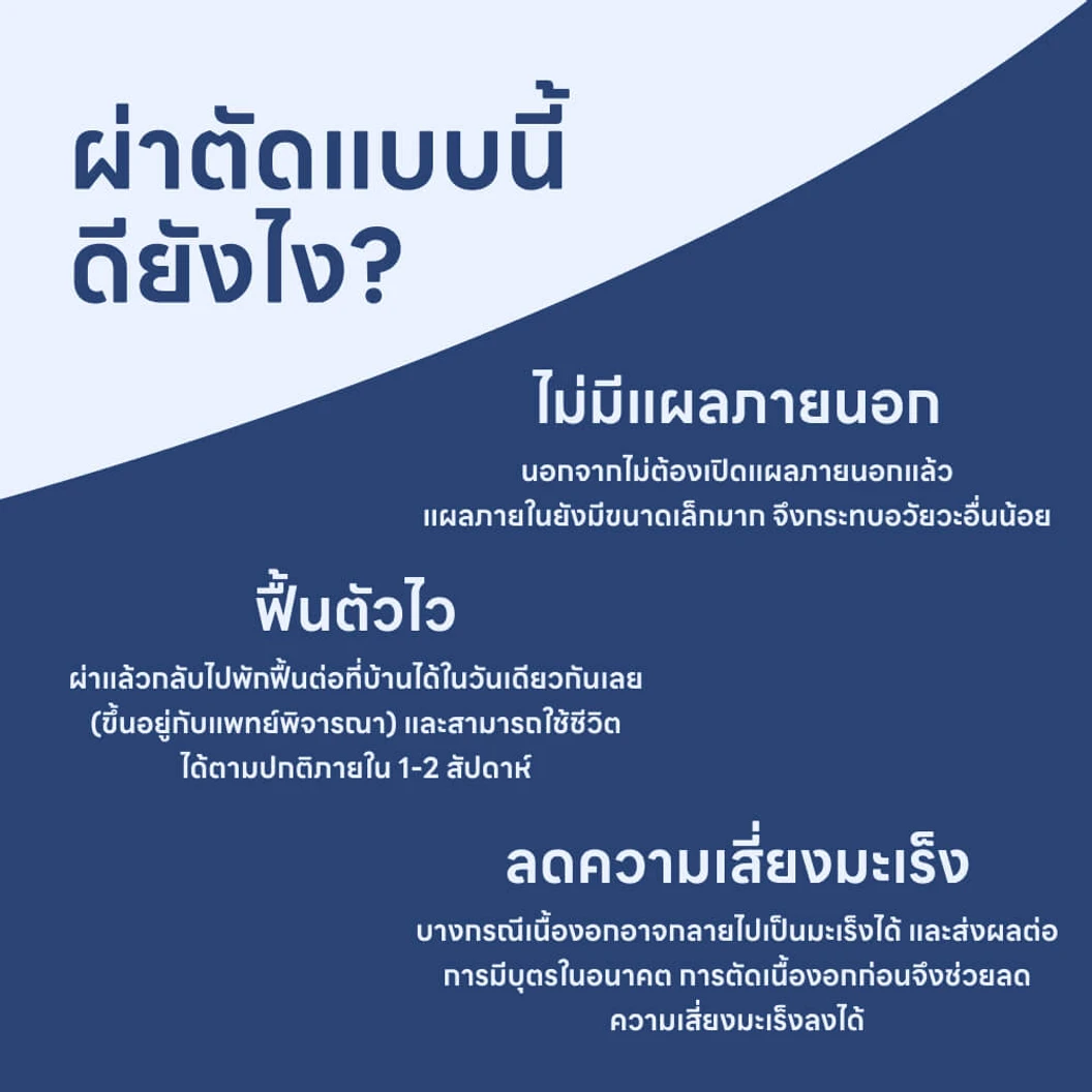 ผ่าตัดเนื้องอกมดลูก (แบบส่องกล้องทางโพรงมดลูก)
