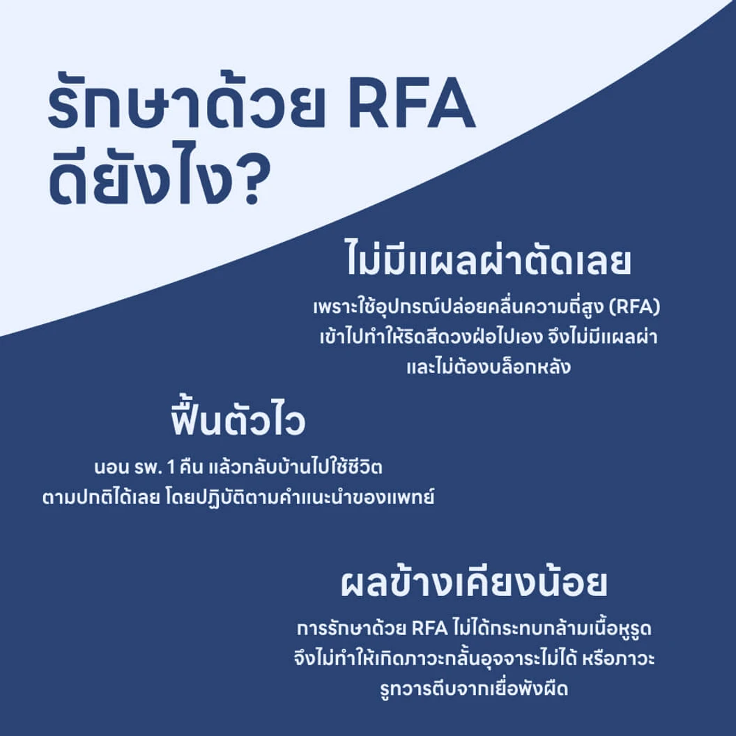 ผ่าตัดริดสีดวง ด้วยคลื่นความถี่สูง RFA (RFA Hemorrhoid)