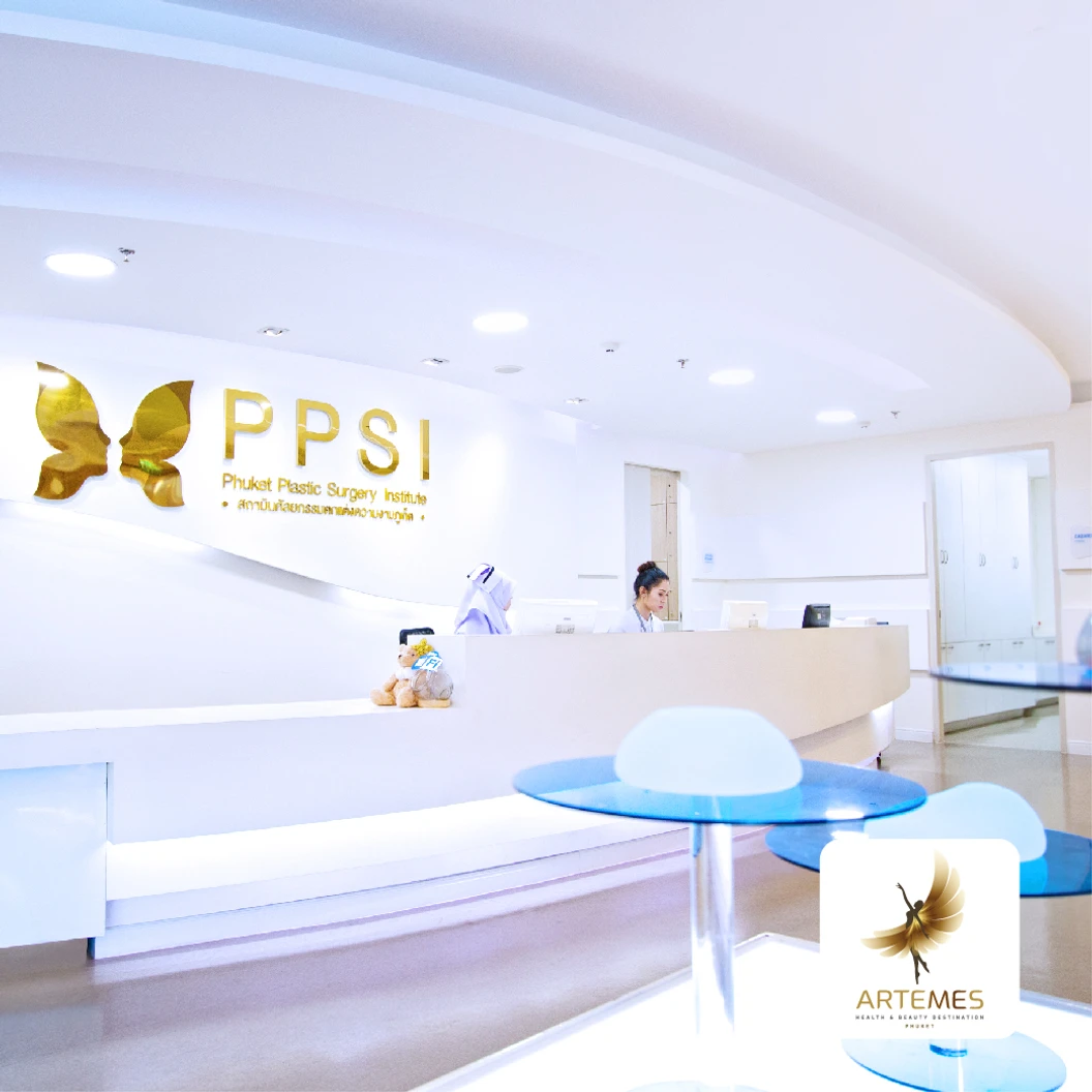 เสริมจมูกด้วยซิลิโคนเกาหลี เทคนิค Open Rhinoplasty สำหรับเคสทำครั้งแรก นอนพักที่ รพ. 2 คืน