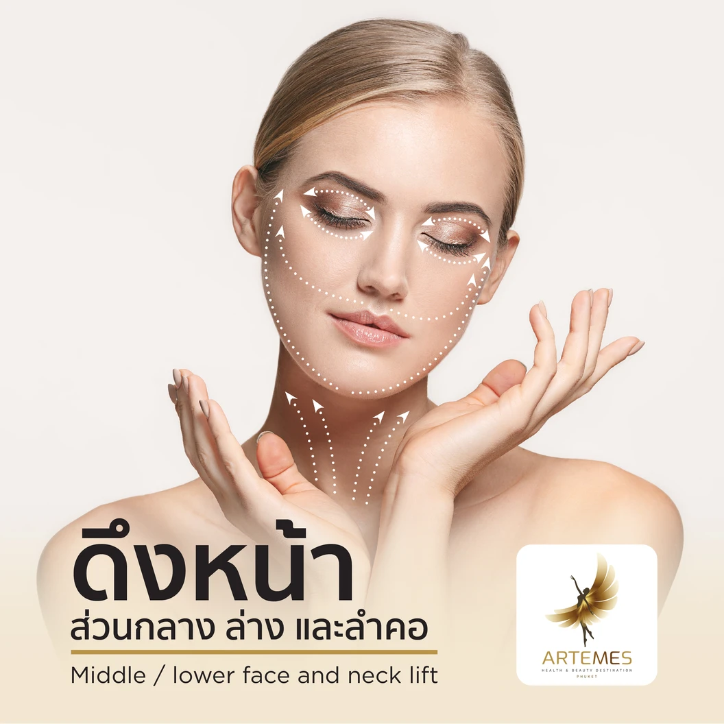 ผ่าตัดดึงหน้าส่วนกลางและลำคอ หรือใบหน้าส่วนล่างและลำคอ ขึ้นอยู่กับแพทย์ประเมิน สำหรับเคสทำครั้งแรก นอนพักที่ รพ. 1 คืน