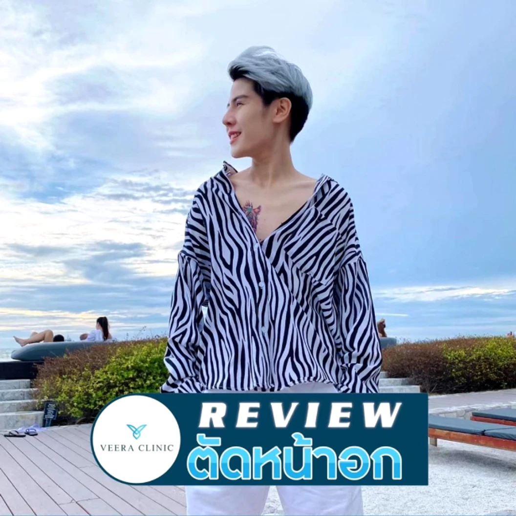 ตัดหน้าอก Mastectomy ขนาดคัพ A แบบแผลยาว สำหรับเคสทำครั้งแรก