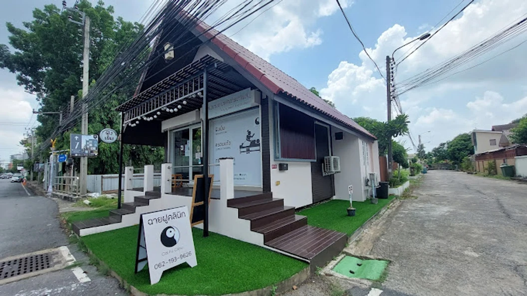 ฝังเข็มปรับสมดุล 1 ครั้ง