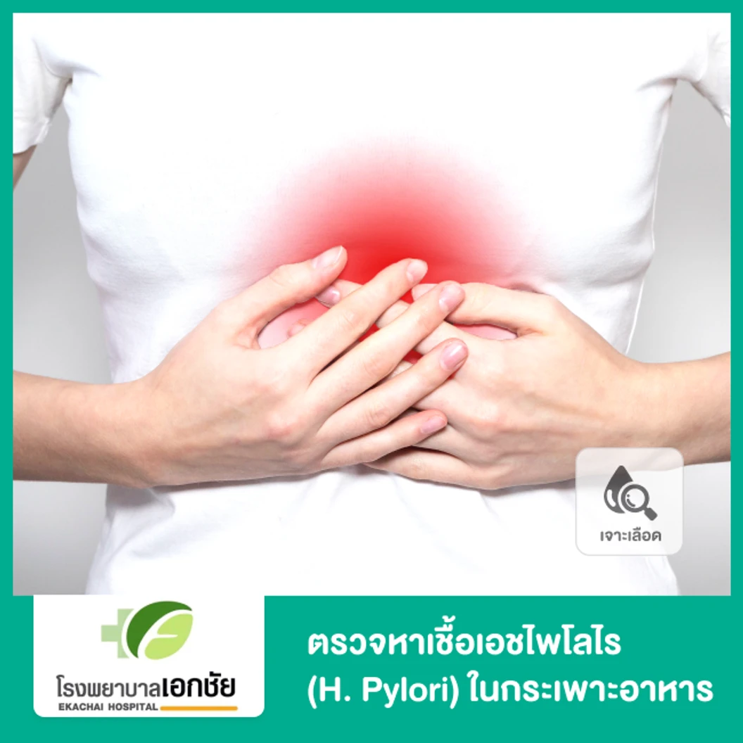 ตรวจหาเชื้อเอชไพโลไร (H. Pylori) ในกระเพาะอาหาร ด้วยวิธีเจาะเลือด