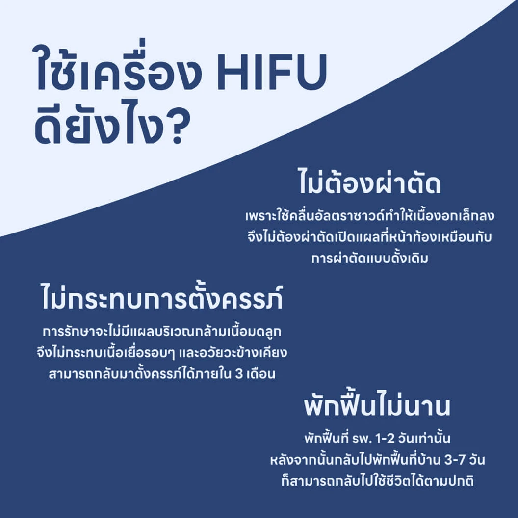 รักษาเนื้องอกกล้ามเนื้อมดลูก ด้วยเครื่อง HIFU (High-Intensity Focused Ultrasound)