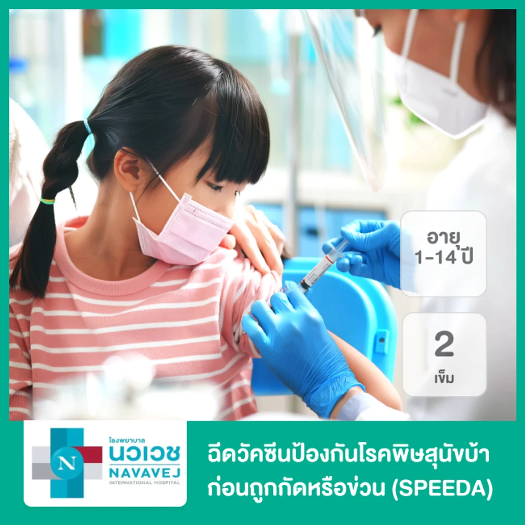 ฉีดวัคซีนป้องกันโรคพิษสุนัขบ้า ก่อนถูกกัดหรือข่วน (SPEEDA) 2 เข็ม สำหรับเด็กอายุ 1-14 ปี