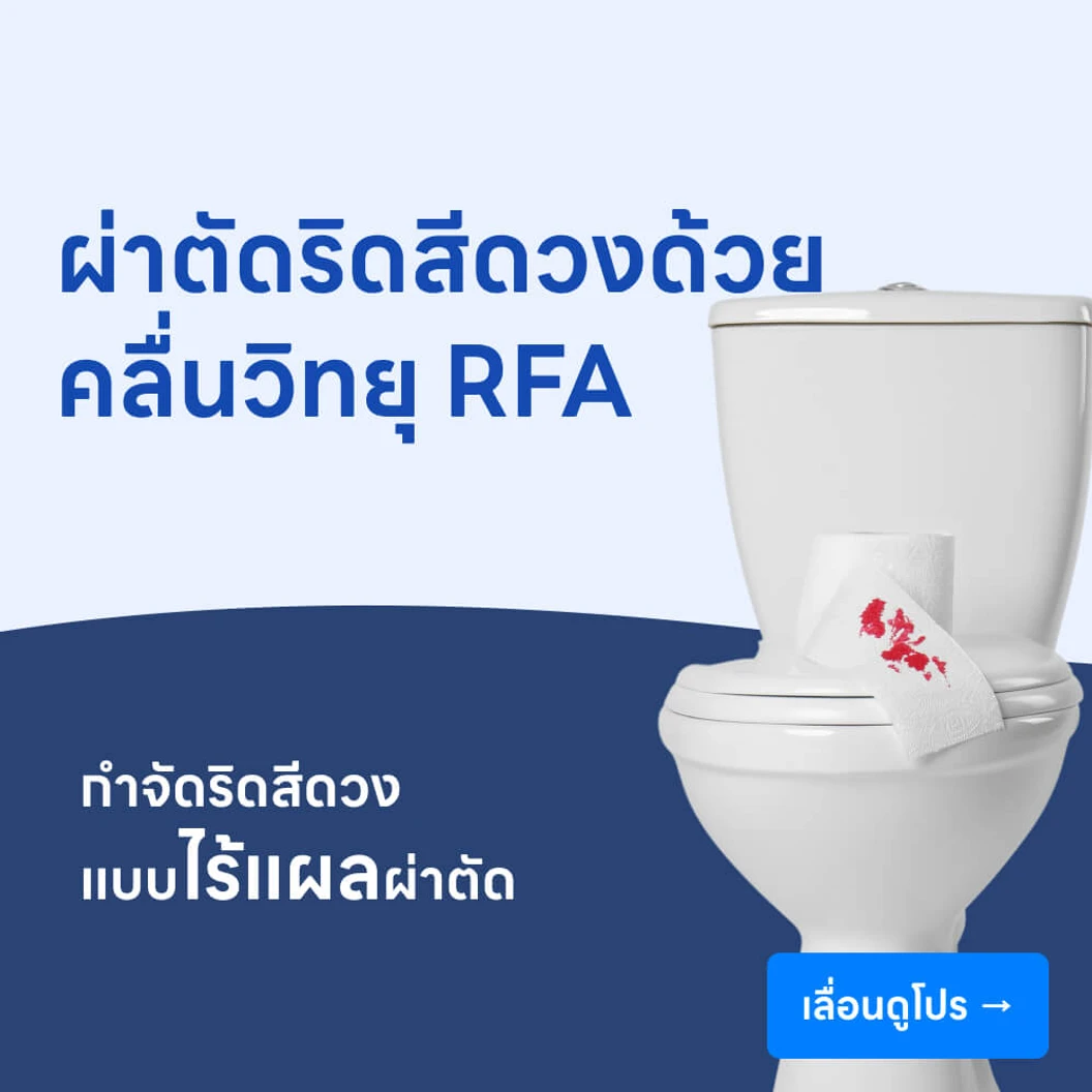 ผ่าตัดริดสีดวง ด้วยคลื่นความถี่สูง RFA (RFA Hemorrhoid)