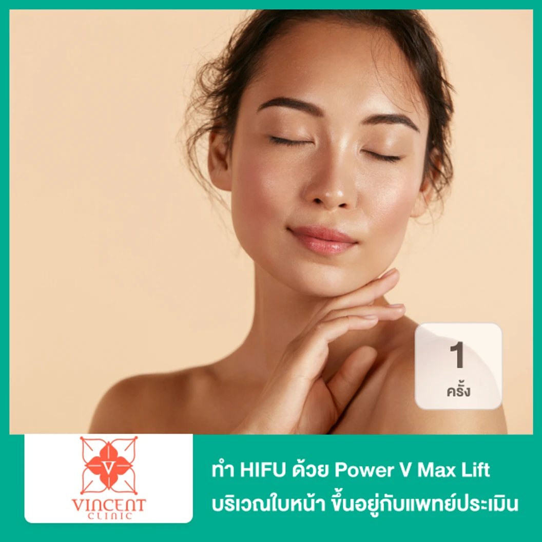 ทำ HIFU ด้วย Power V Max Lift บริเวณใบหน้า จำนวนช็อตขึ้นอยู่กับแพทย์ประเมิน 1 ครั้ง