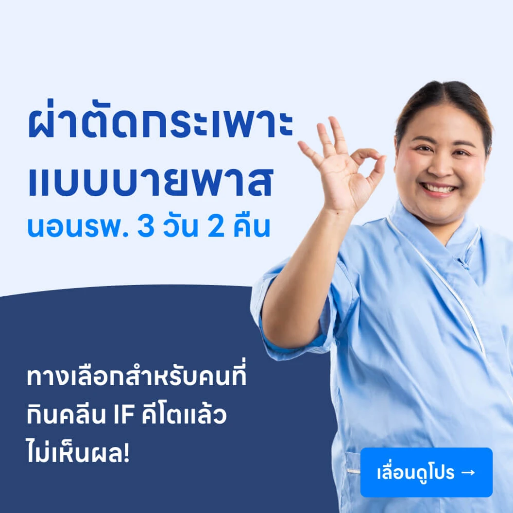 ผ่าตัดกระเพาะอาหารแบบบายพาส เพื่อลดน้ำหนัก 3 วัน 2 คืน (Laparoscopic Sleeve Gastrectomy Plus Proximal Jejunal Bypass)