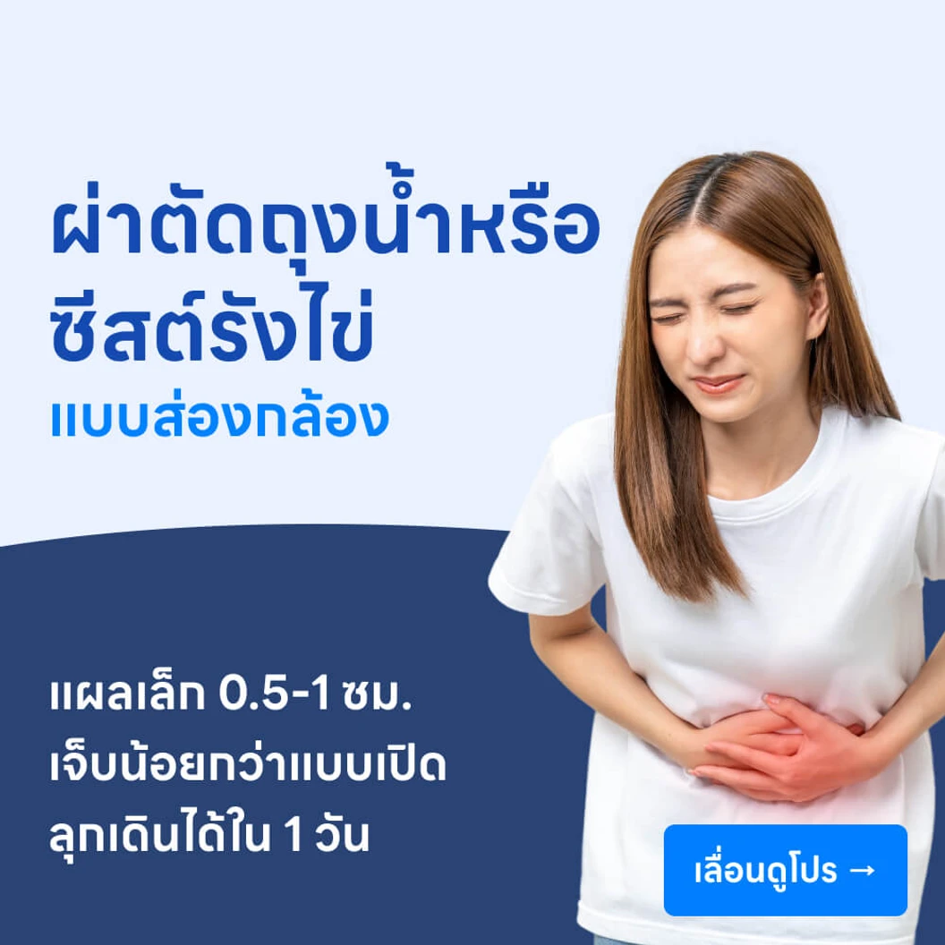 ผ่าตัดถุงน้ำหรือซีสต์รังไข่ (แบบส่องกล้อง)