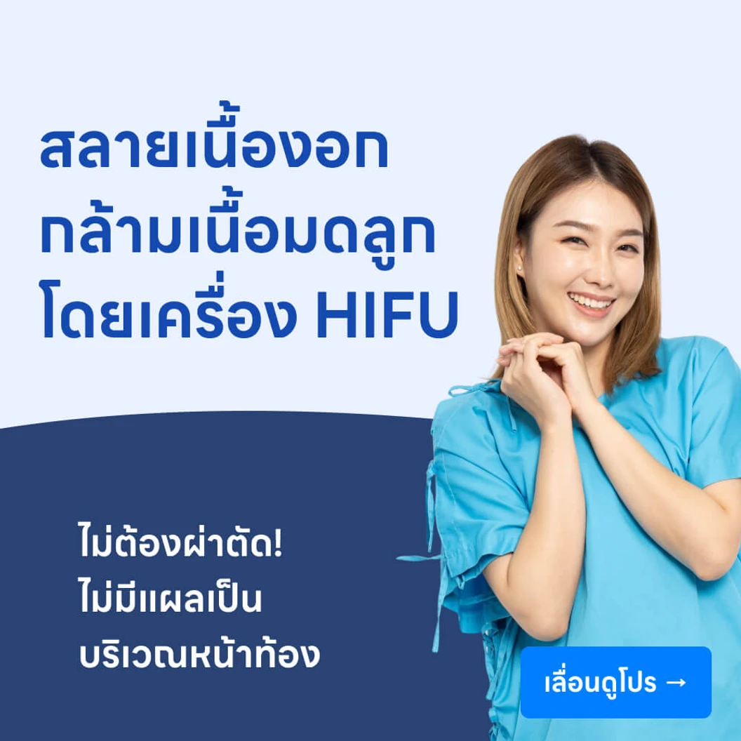 รักษาเนื้องอกกล้ามเนื้อมดลูก ด้วยเครื่อง HIFU (High-Intensity Focused Ultrasound)