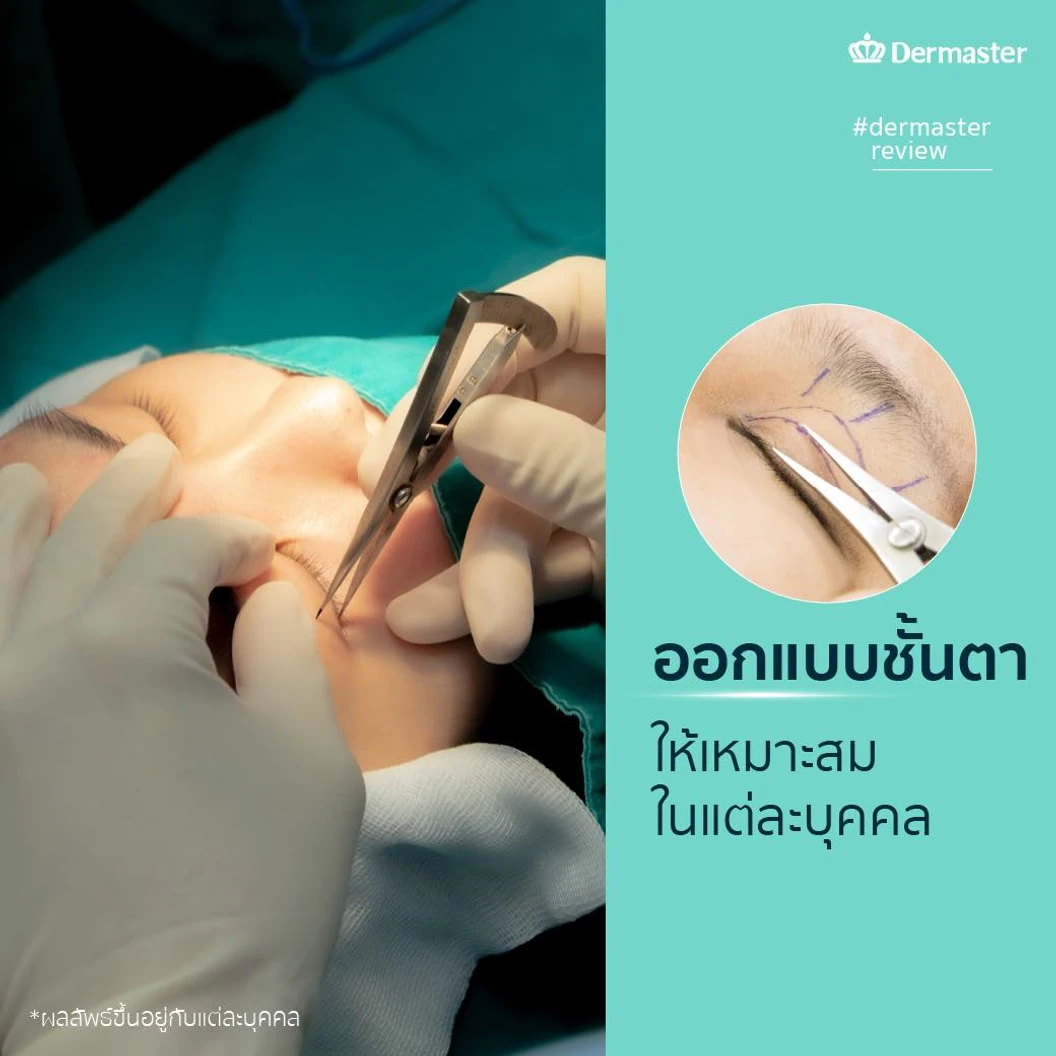 ทำตา 2 ชั้น สำหรับเคสทำครั้งแรก