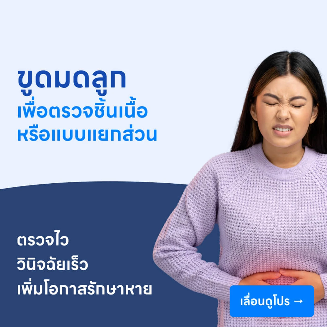 ขูดมดลูกตรวจชิ้นเนื้อ/ขูดมดลูกแบบแยกส่วน