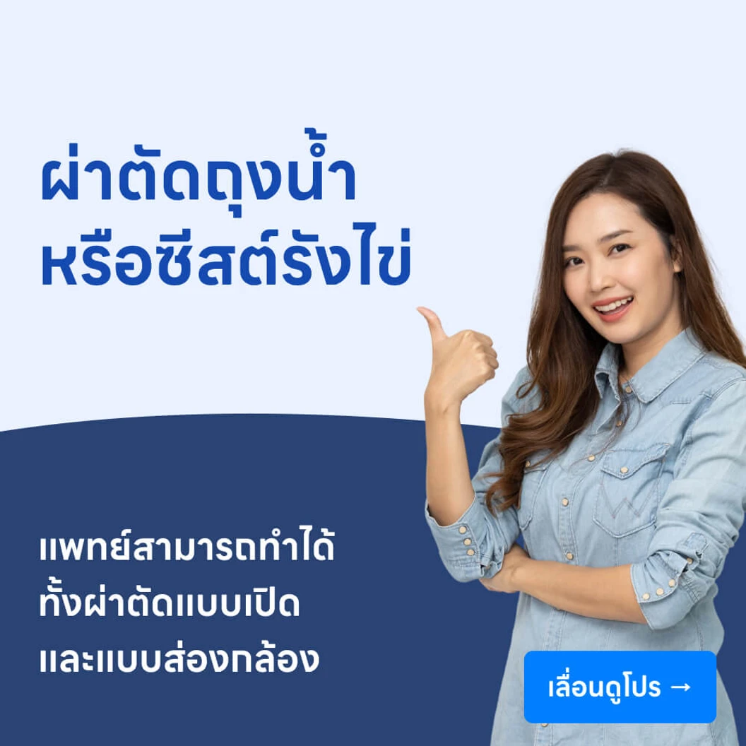 ผ่าตัดถุงน้ำหรือซีสต์รังไข่