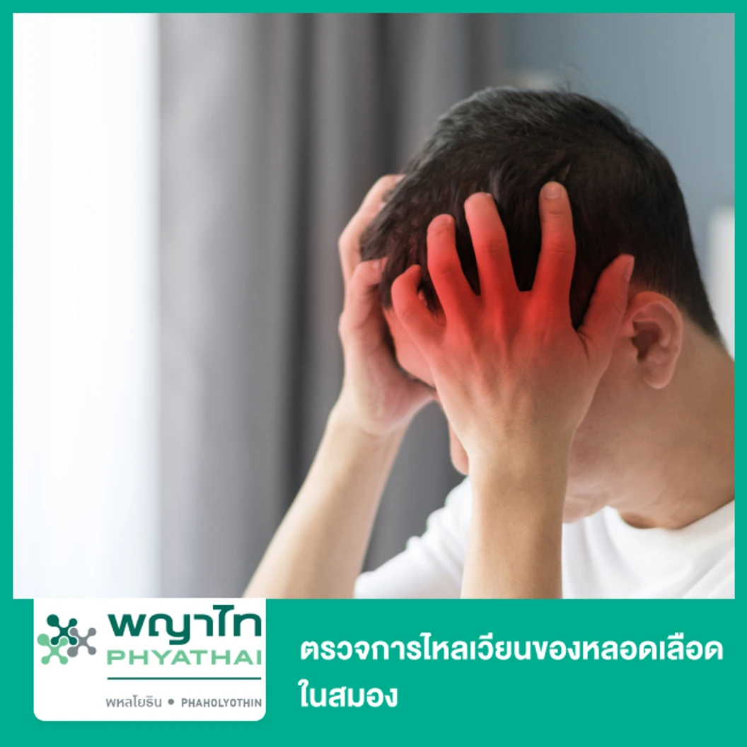 ตรวจการไหลเวียนของหลอดเลือดในสมอง ด้วยคลื่นความถี่สูง TCD (Transcranial Doppler)