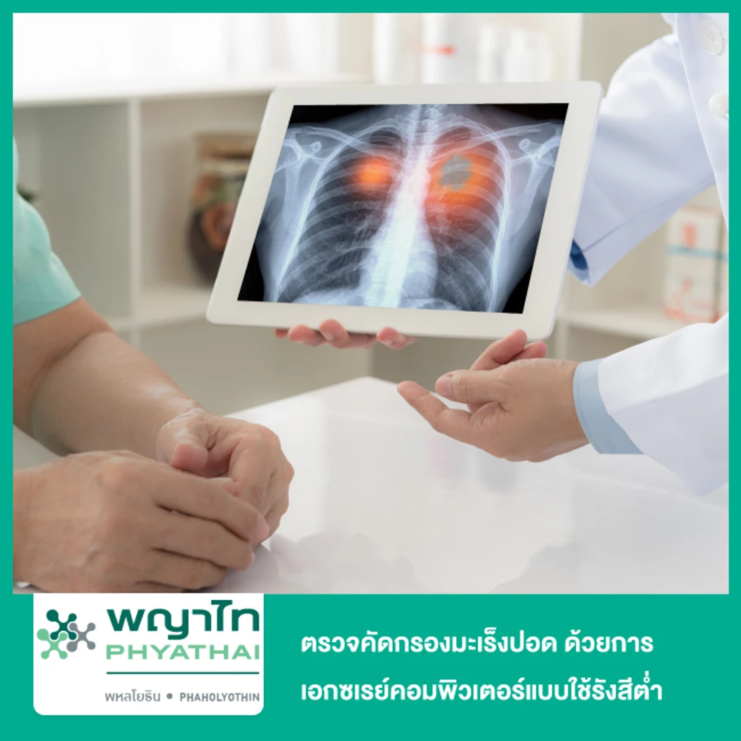 ตรวจคัดกรองมะเร็งปอด ด้วยการเอกซเรย์คอมพิวเตอร์แบบใช้รังสีต่ำ (CT Lung Low Dose)