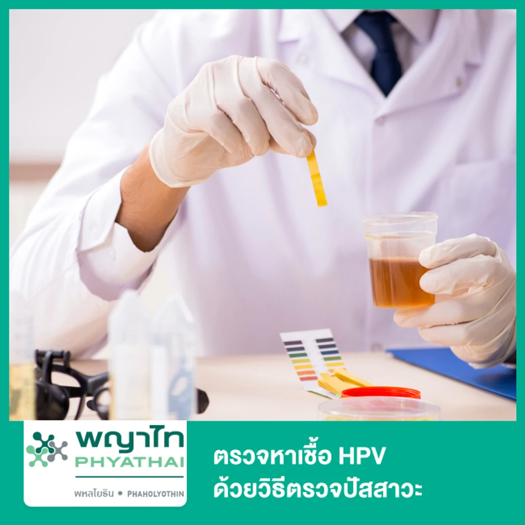 ตรวจหาเชื้อ HPV DNA ด้วยวิธีตรวจปัสสาวะ สำหรับผู้หญิงหรือผู้ชาย